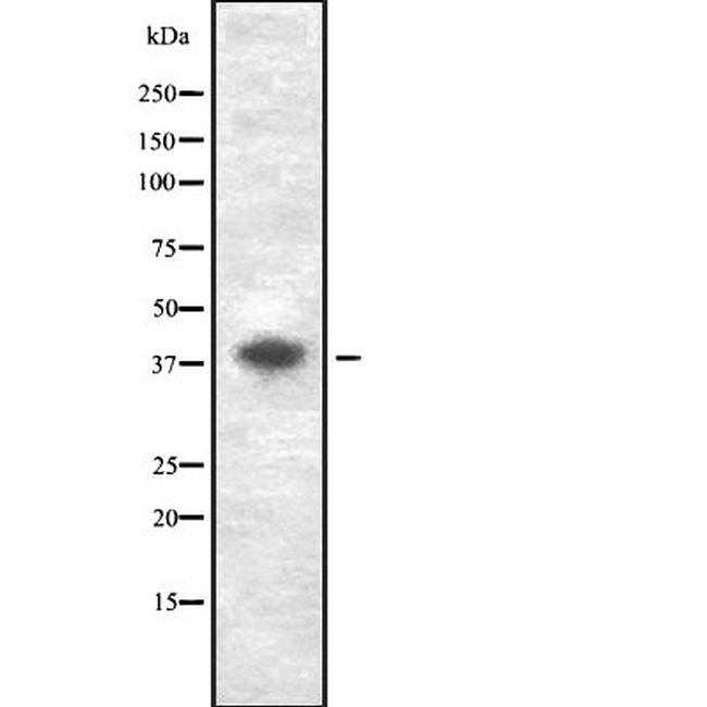 GDF3 Antibody in Western Blot (WB)
