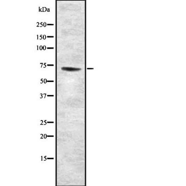 GUCY1B2 Antibody in Western Blot (WB)