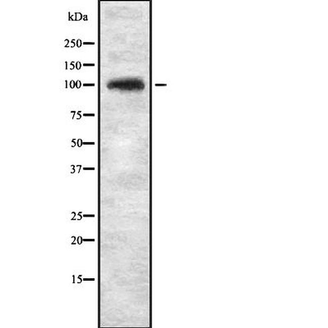 KIF20A Antibody in Western Blot (WB)