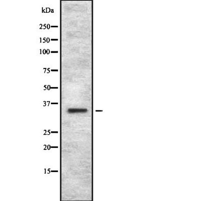 OR4C12 Antibody in Western Blot (WB)