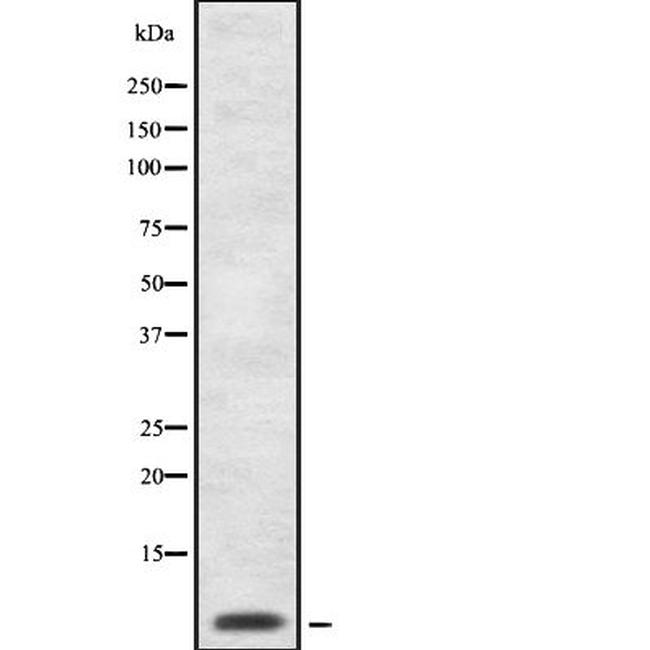 CD52 Antibody in Western Blot (WB)