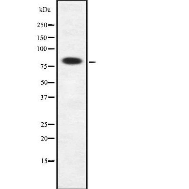 FAM111B Antibody in Western Blot (WB)