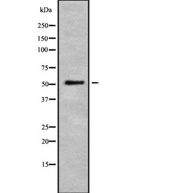 HTR2A Antibody in Western Blot (WB)