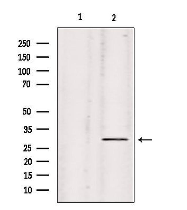 COL9A2 Antibody in Western Blot (WB)
