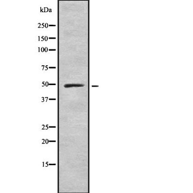 IFI44 Antibody in Western Blot (WB)