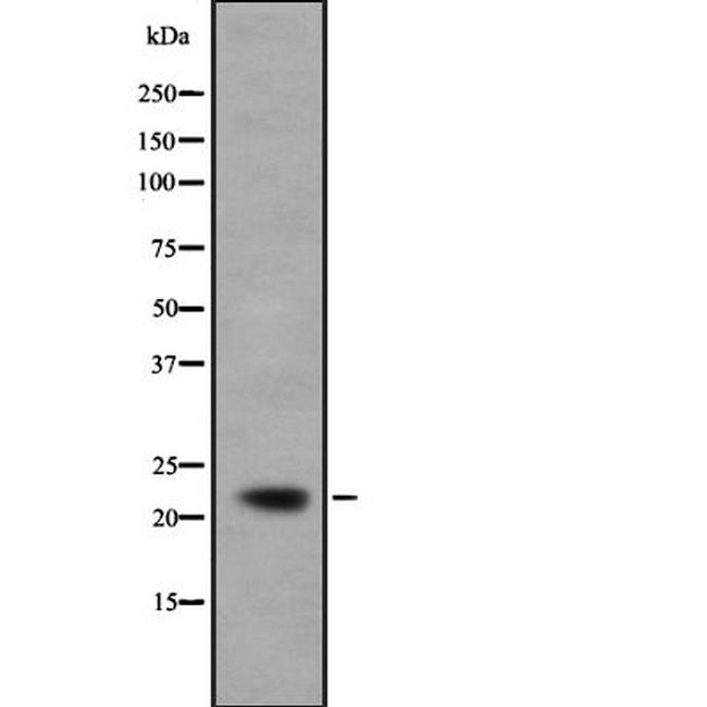 IFNA5 Antibody in Western Blot (WB)
