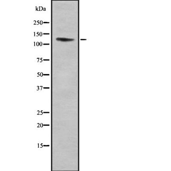 ITGA11 Antibody in Western Blot (WB)