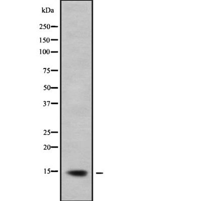 LAMTOR2 Antibody in Western Blot (WB)