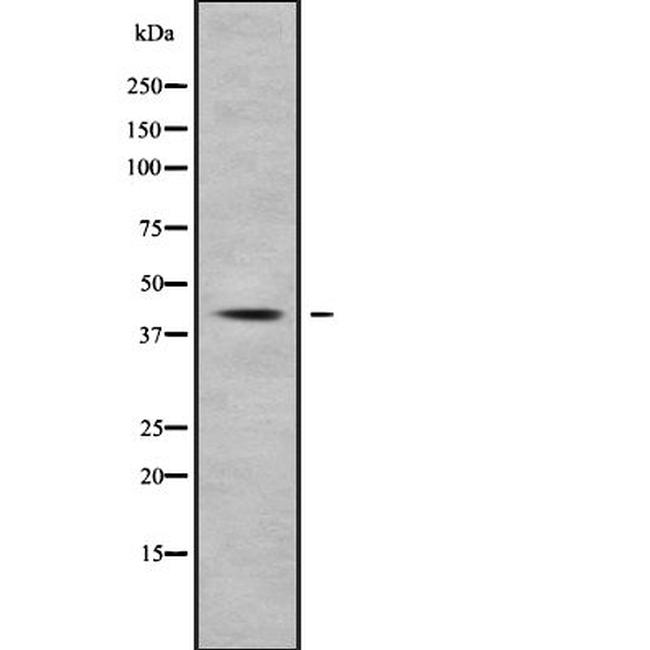 NFKBIL1 Antibody in Western Blot (WB)