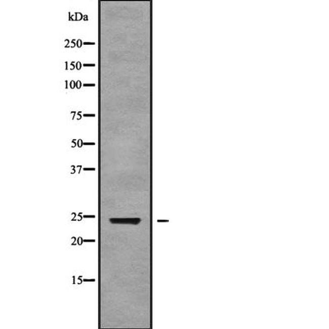ALKBH7 Antibody in Western Blot (WB)