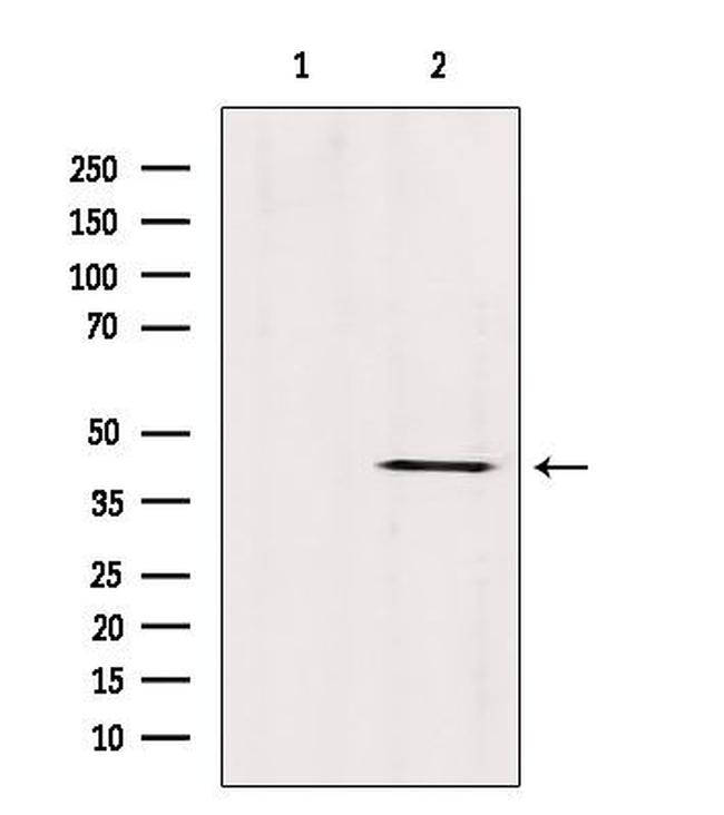 ABHD13 Antibody in Western Blot (WB)