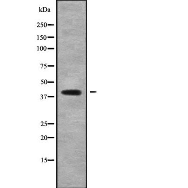 ABHD13 Antibody in Western Blot (WB)