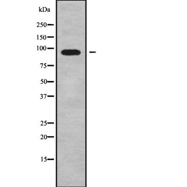 ADAM29 Antibody in Western Blot (WB)
