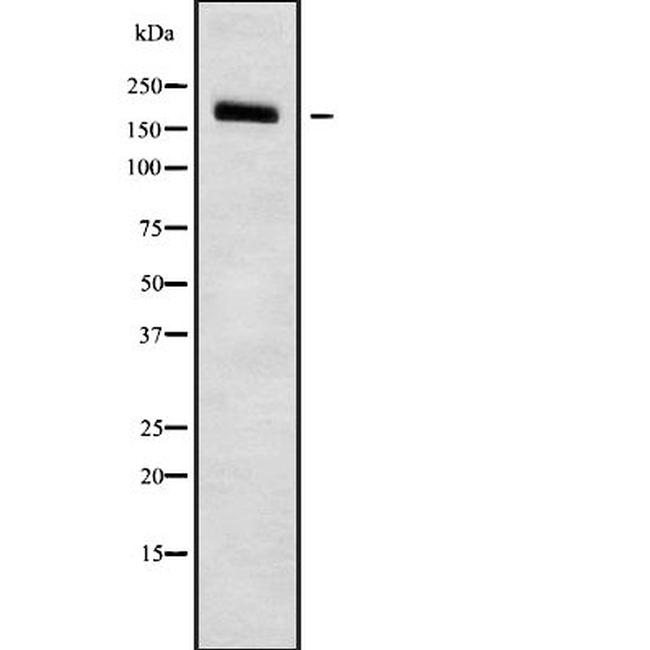 PDS5B Antibody in Western Blot (WB)