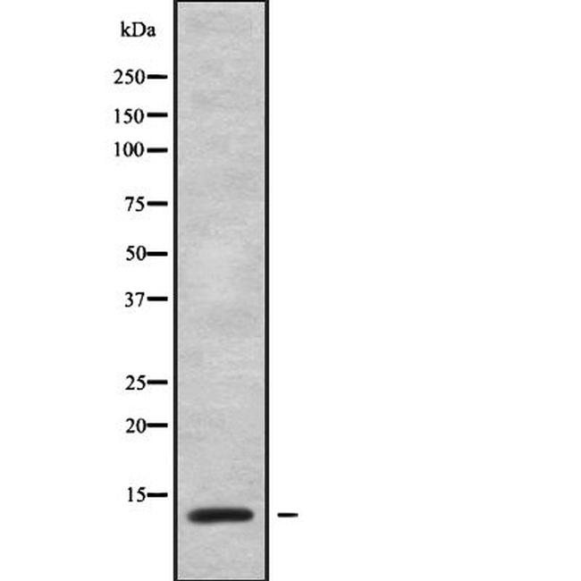 ATP5L Antibody in Western Blot (WB)