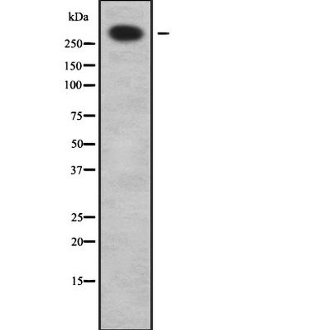 ABCA12 Antibody in Western Blot (WB)