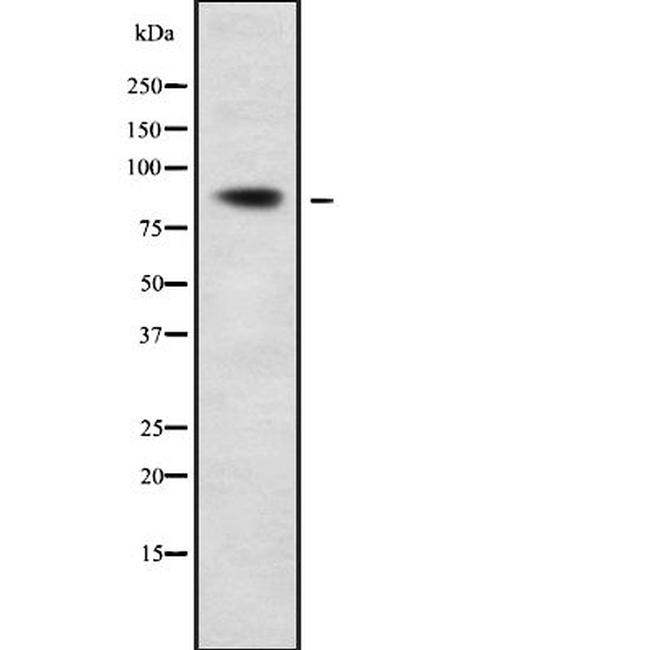 CPXM2 Antibody in Western Blot (WB)