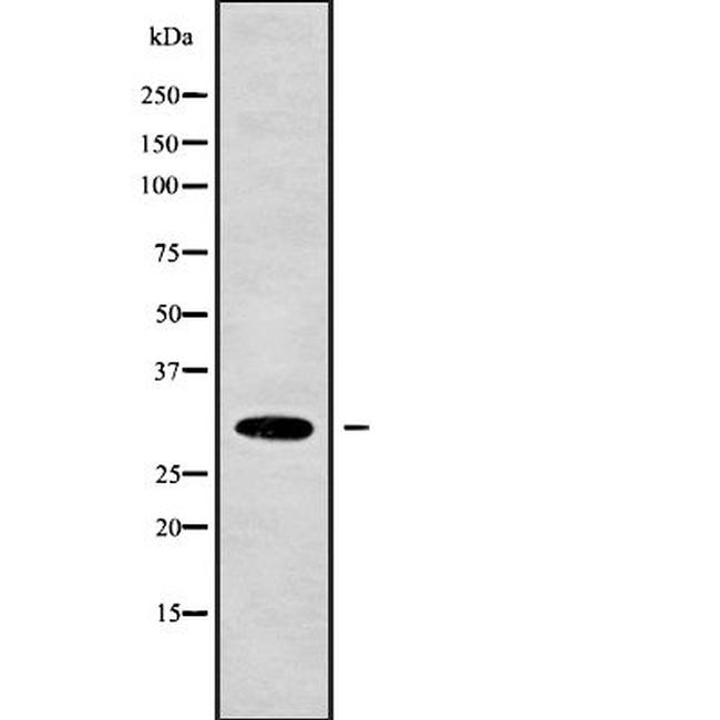 CEACAM7 Antibody in Western Blot (WB)