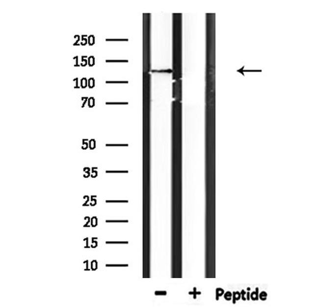 Catenin delta-2 Antibody in Western Blot (WB)