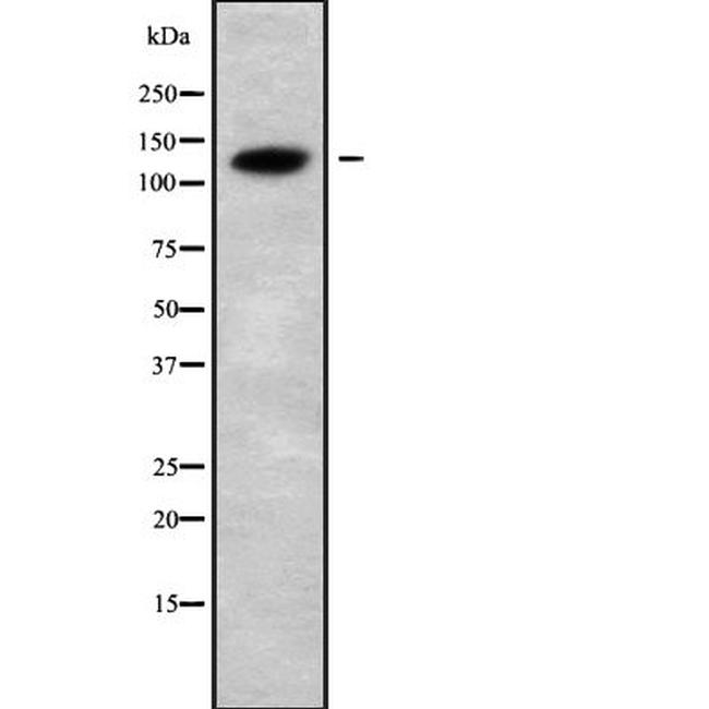 CATSPERB Antibody in Western Blot (WB)