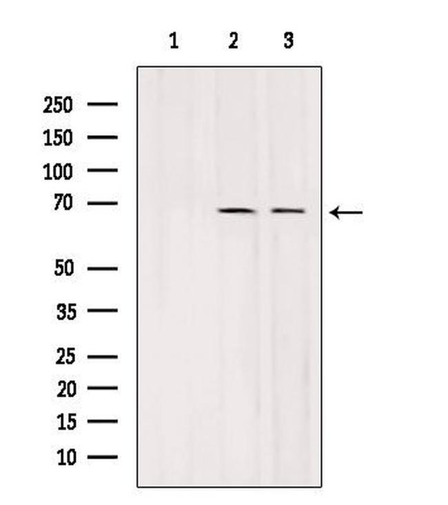 SLC7A3 Antibody in Western Blot (WB)