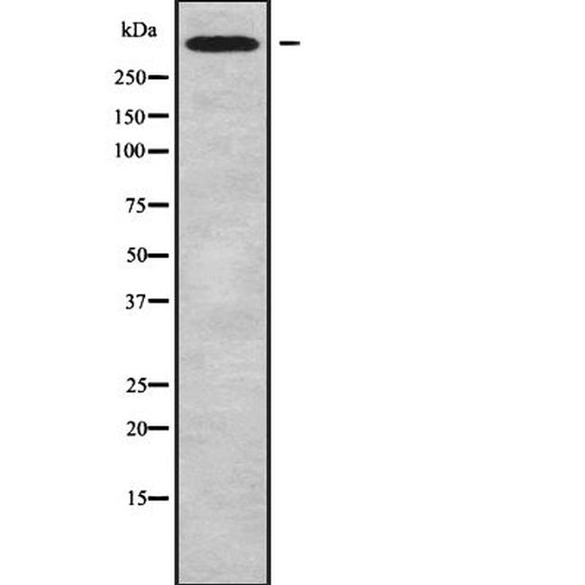 CHD6 Antibody in Western Blot (WB)
