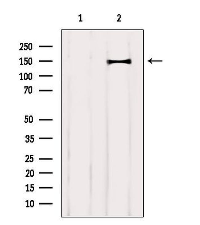 CNTNAP4 Antibody in Western Blot (WB)