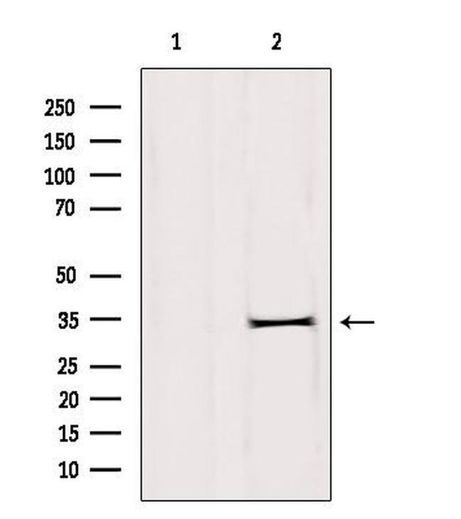 DHRS1 Antibody in Western Blot (WB)