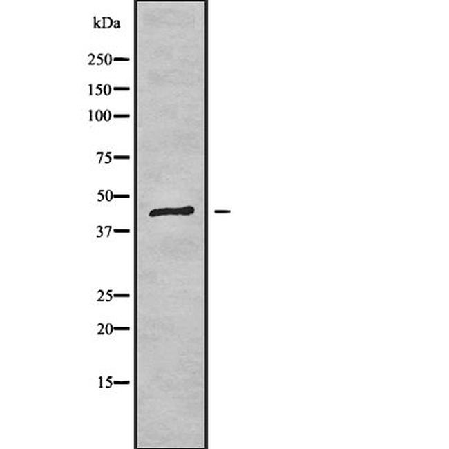 DGAT2 Antibody in Western Blot (WB)