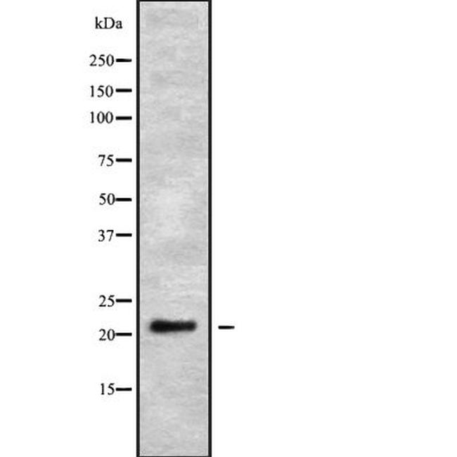 GINS2 Antibody in Western Blot (WB)