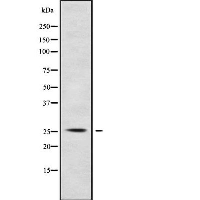 POLR3G Antibody in Western Blot (WB)