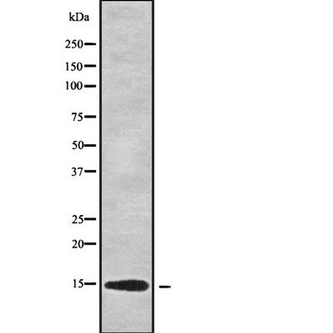 POLR2F Antibody in Western Blot (WB)