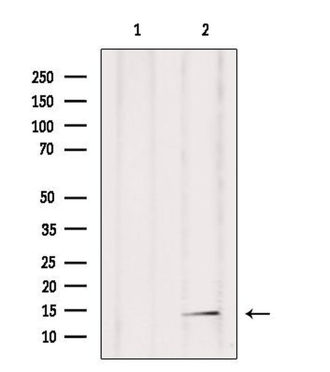 POLR2F Antibody in Western Blot (WB)