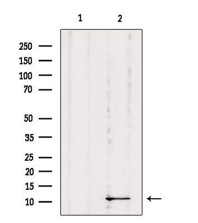 DYNLRB1 Antibody in Western Blot (WB)