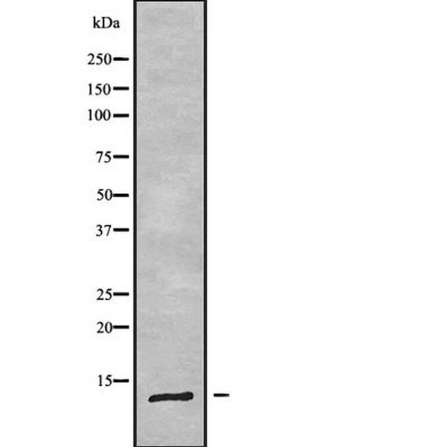 DYNLRB2 Antibody in Western Blot (WB)