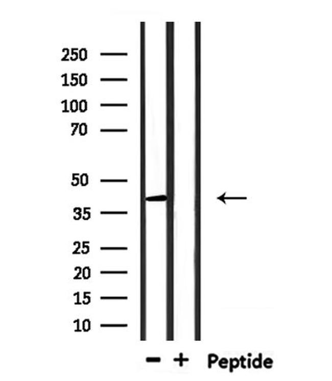 RNF167 Antibody in Western Blot (WB)
