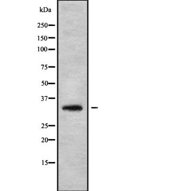 HOXA1/HOXB1/HOXD1 Antibody in Western Blot (WB)