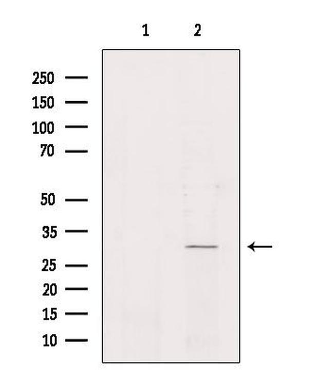 NKX6-2 Antibody in Western Blot (WB)