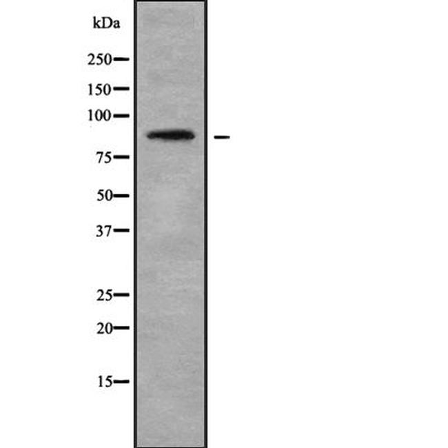 PCQAP Antibody in Western Blot (WB)