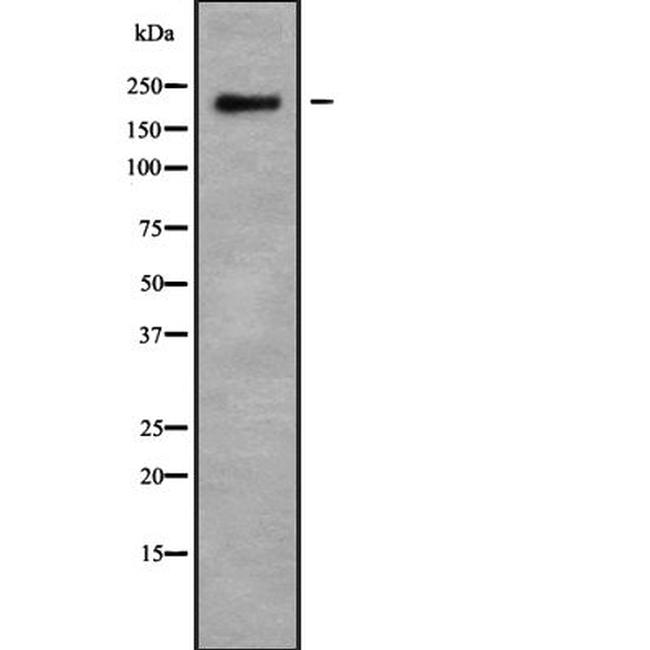 MUC4 Antibody in Western Blot (WB)