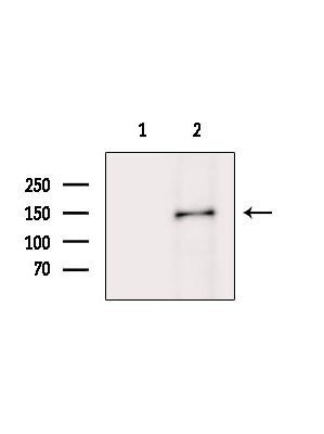 MYO3B Antibody in Western Blot (WB)