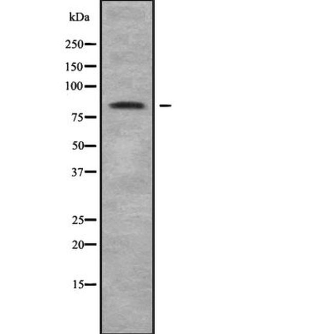 NOL11 Antibody in Western Blot (WB)