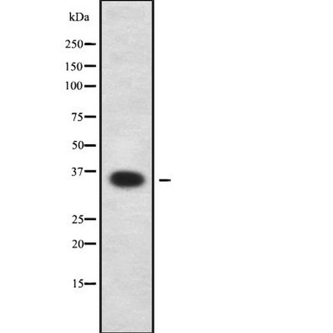 OR6N1 Antibody in Western Blot (WB)