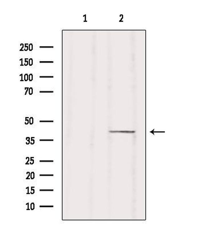 ZDHHC18 Antibody in Western Blot (WB)