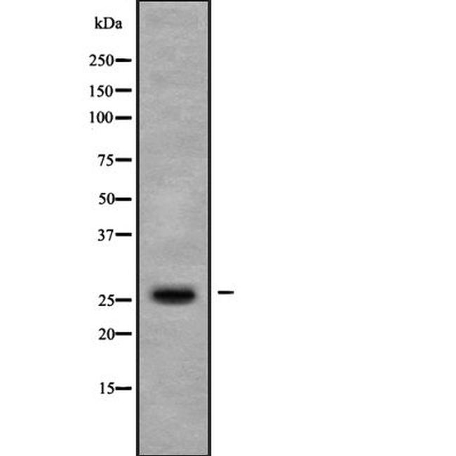 C5orf26 Antibody in Western Blot (WB)