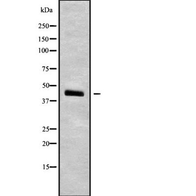 SEPT5 Antibody in Western Blot (WB)