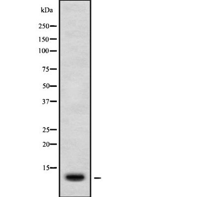 CXCL11 Antibody in Western Blot (WB)