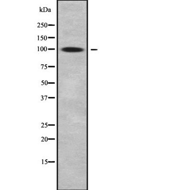 SLC9A5 Antibody in Western Blot (WB)