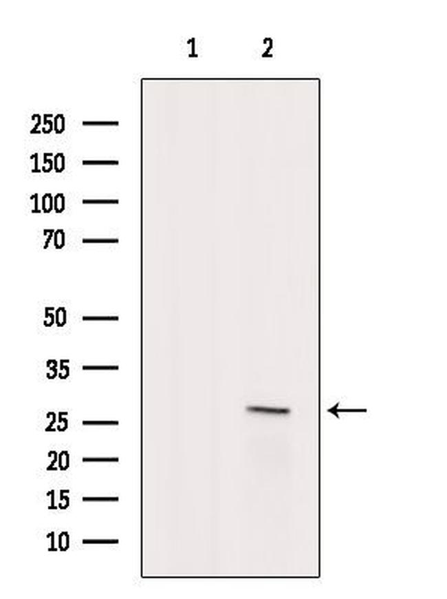 TCEAL2 Antibody in Western Blot (WB)