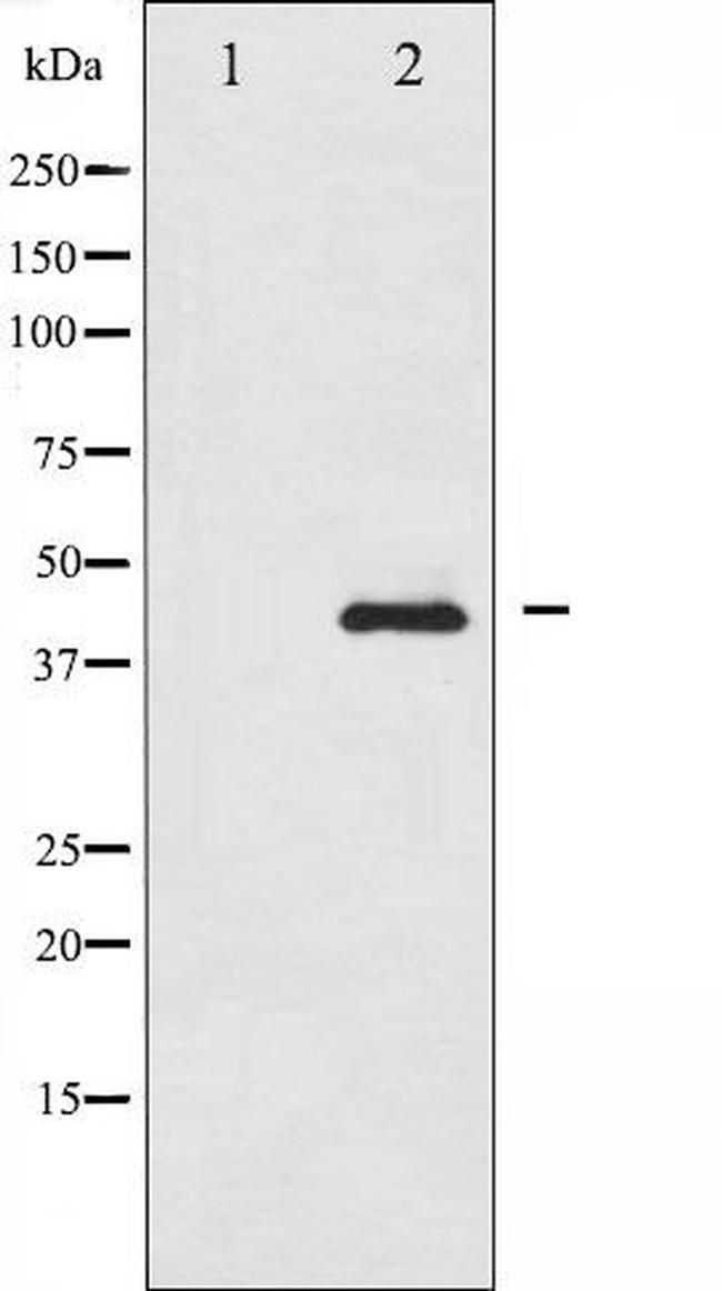 Phospho-Smad3 (Ser208) Antibody in Western Blot (WB)